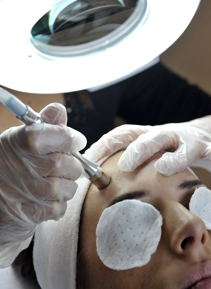 Microdermoabrasion